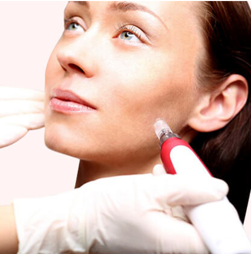 Microneedling with Peptides