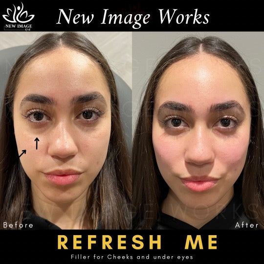 Refresh Me