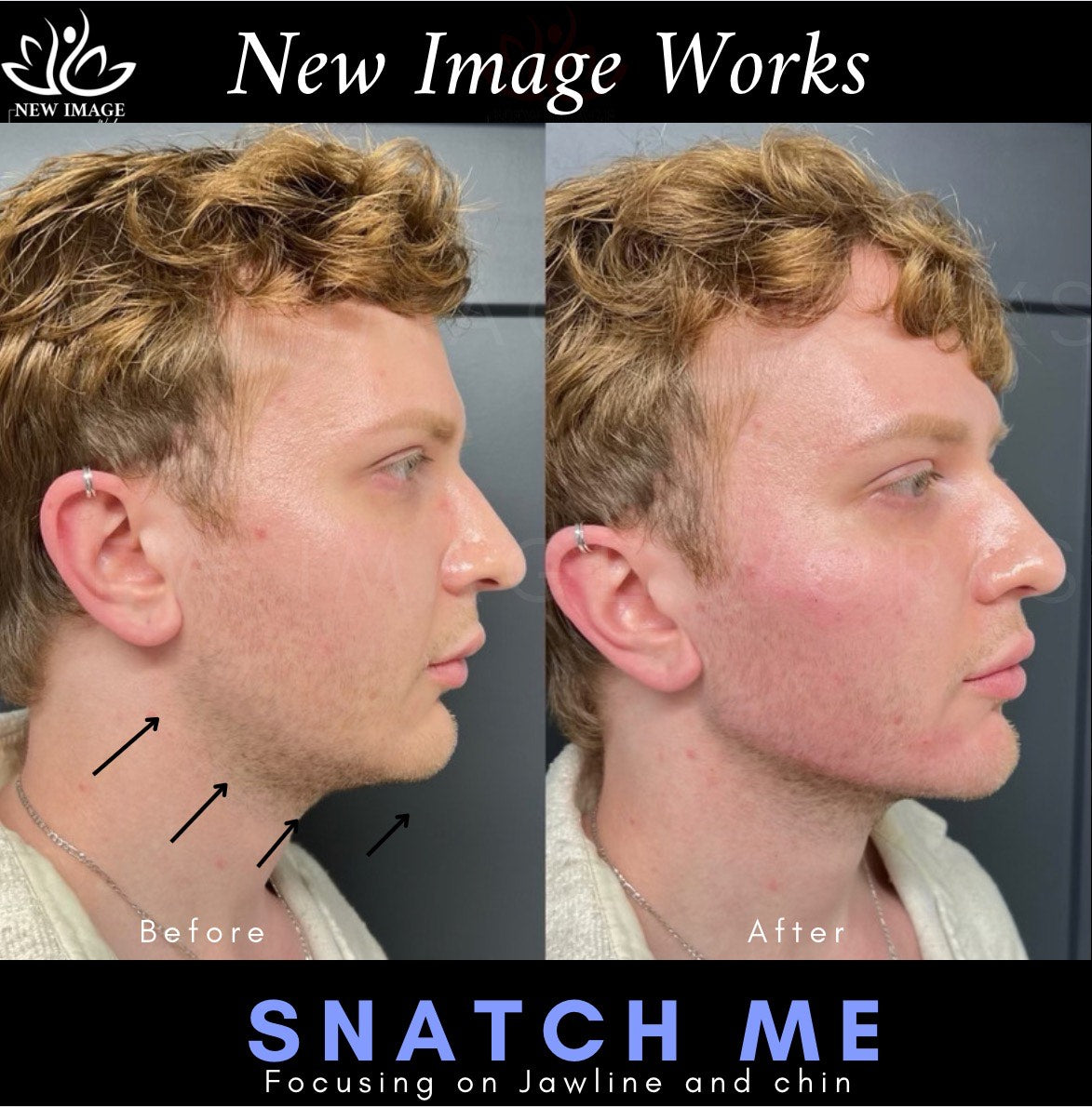 Snatch Me