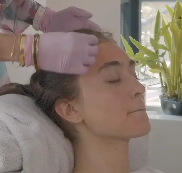 VI Chemical Peel
